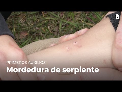 Vídeo: Mordeduras De Serpientes Venenosas: Primeros Auxilios Para Mordeduras De Serpientes / Víboras