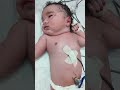 Adorable 4.5kg Baby in NICU#newbornbaby#youtubeshorts 😇