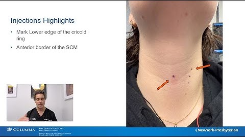 In-Office RCPD Botulinum Toxin Injection- How I Do It