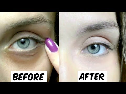 How To Remove Dark Circles Permanently In Just 5 Days