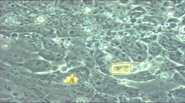 The Unseen I Videos from the Microscope Imaging Station I Exploratorium