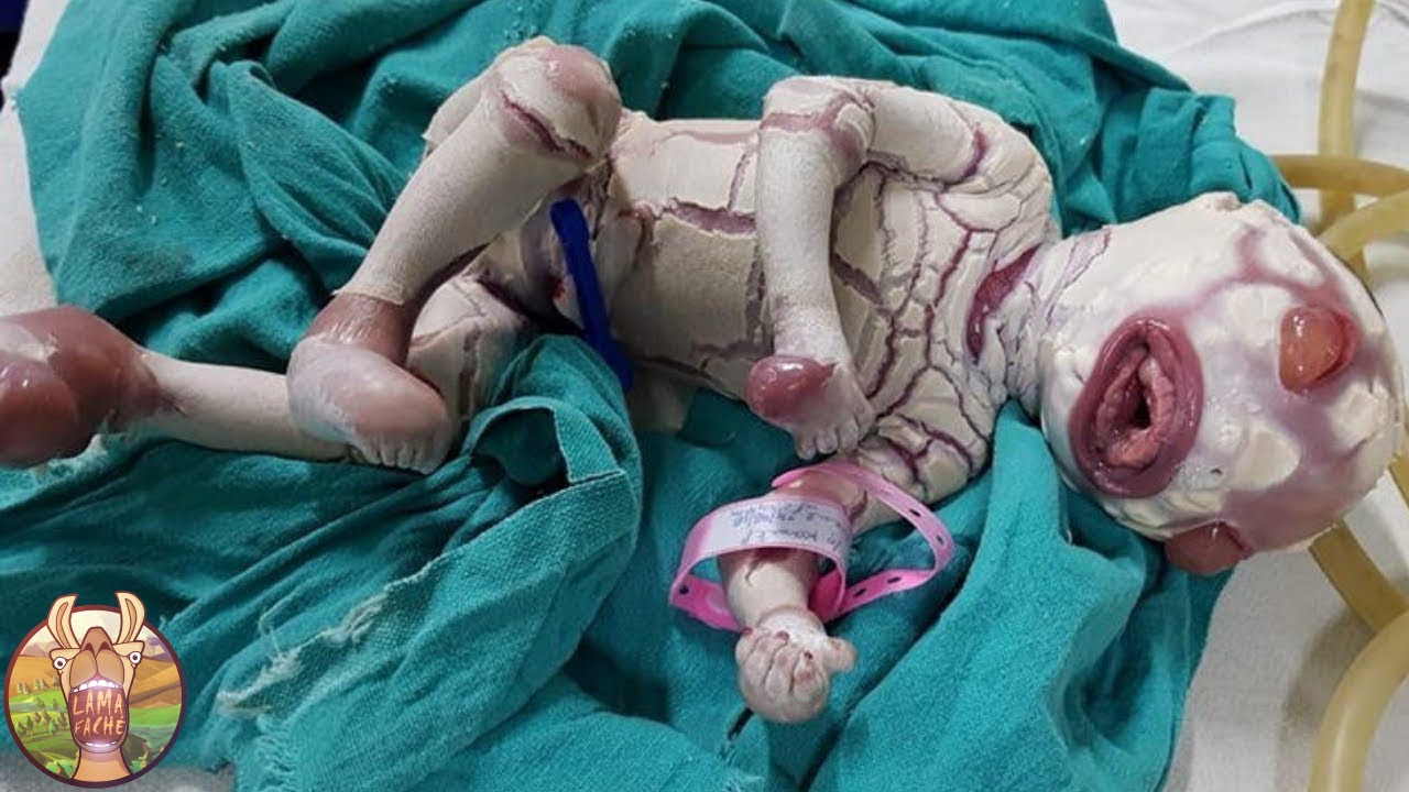 10 Bebes Inhabituels Qui Existent Vraiment Youtube 10 Bebes Inhabituels Qui Existent Vraiment Youtube