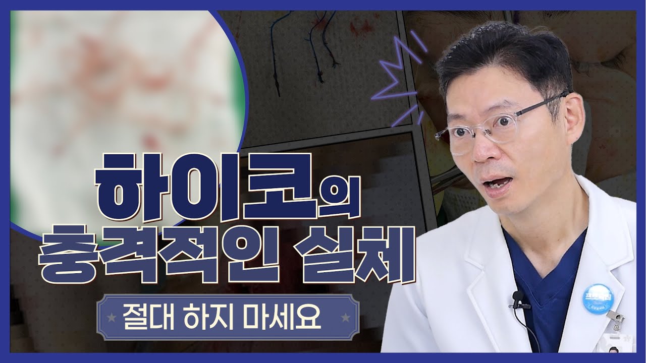 "하이코" 하면 안되는 이유