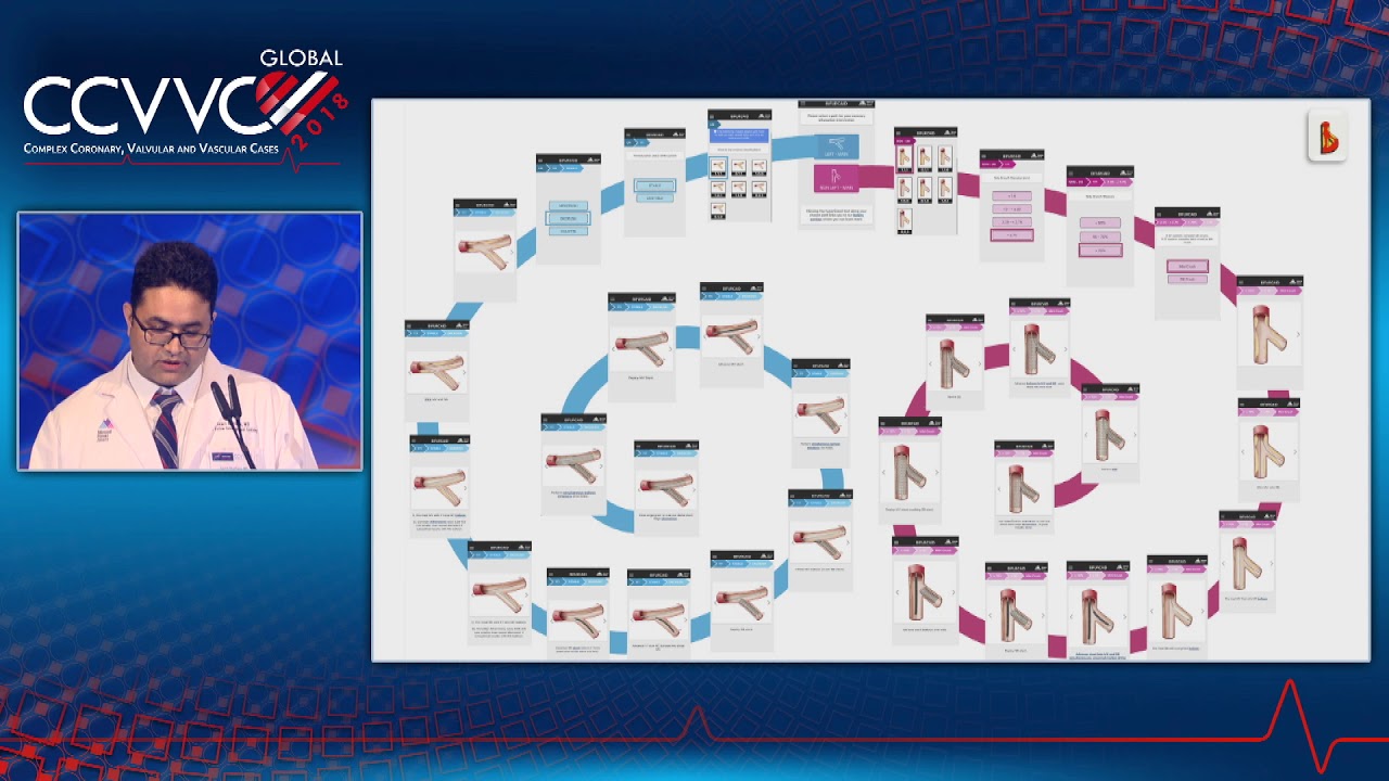 Bifurcation Intervention: Bifurcaid App