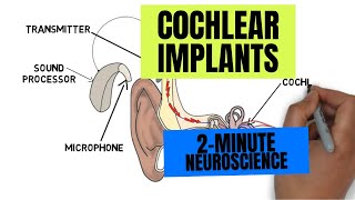 2-Minute Neuroscience: Cochlear Implants by Neuroscientifically Challenged 13,643 views 9 months ago 1 minute, 44 seconds