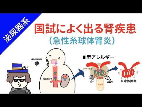 【国試対策】腎疾患その1（急性糸球体腎炎）