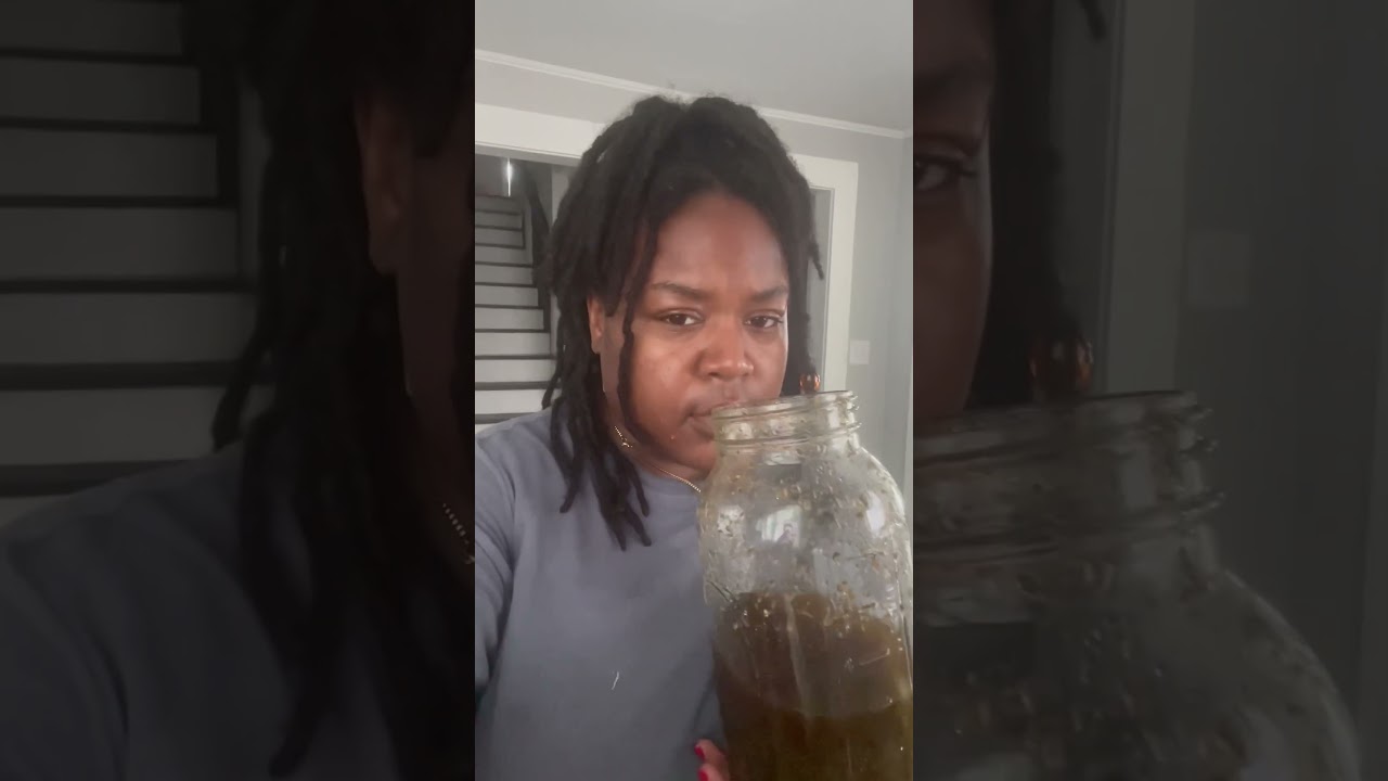 Heal migraines naturally | 