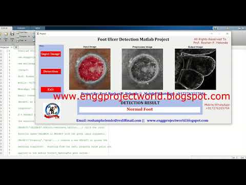Foot Ulcer Detection Using Image Processing With Source Code | Foot Ulcer Classification Using CNN