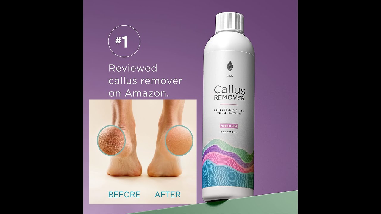  Professional Best Callus Remover Gel for Feet and Foot