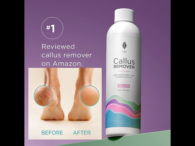 best selling,Best Callus Remover. Callus Eliminator, Liquid