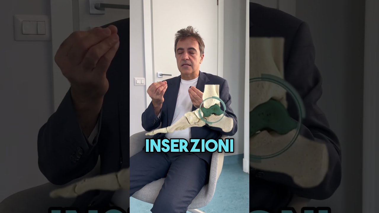 Necrosi dell’astragalo