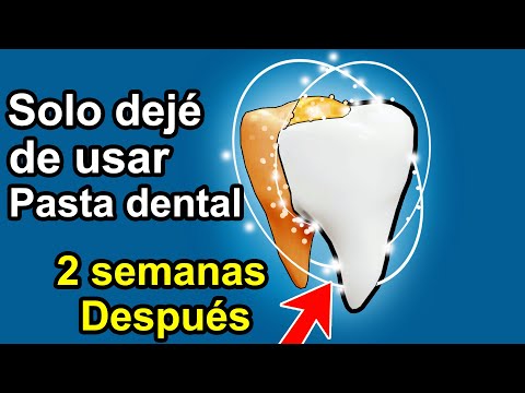 Dejé <strong>de</strong> usar PASTA <strong>DENTAL</strong> durante 1 Mes | Ya no me duelen dientes ni voy a Odontología nunca más!