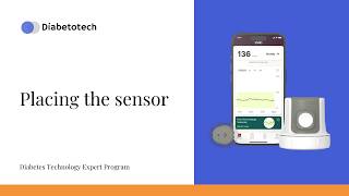 Stelo Glucose Biosensor System | Placing the sensor | Diabetotech
