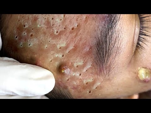 Видео: Relaxing Everyday With Loan Nguyen Skincare