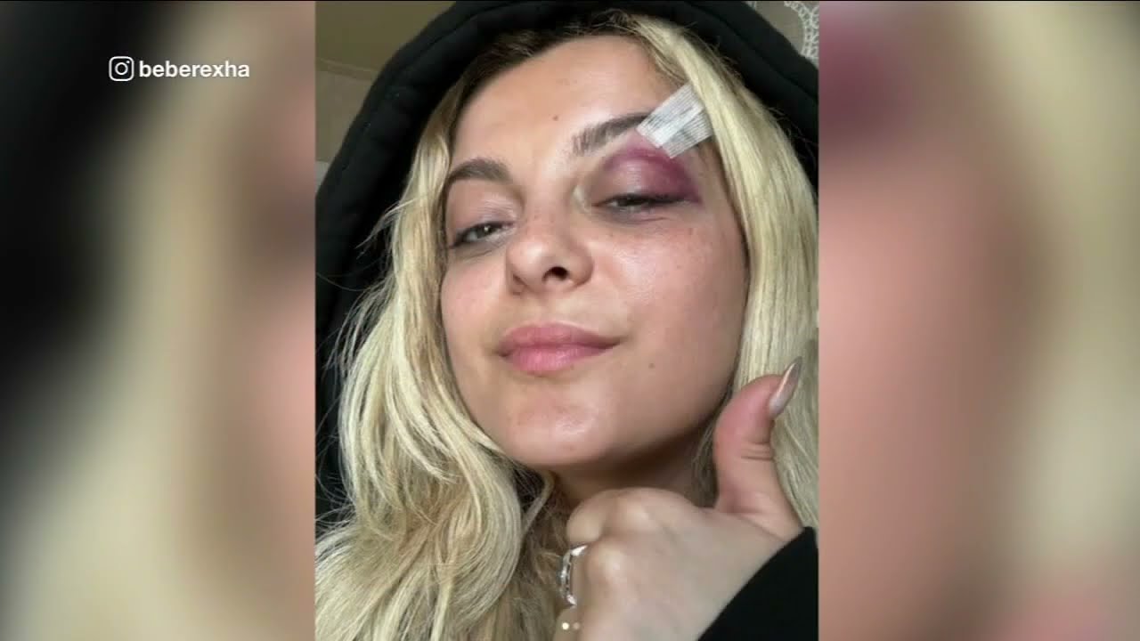 Bebe Rexha injured after cellphone hits her during concert in Lower ...