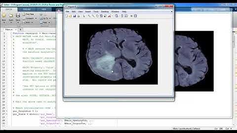 Image Processing Projects Using Opencv | Image Processing Thesis Using Opencv