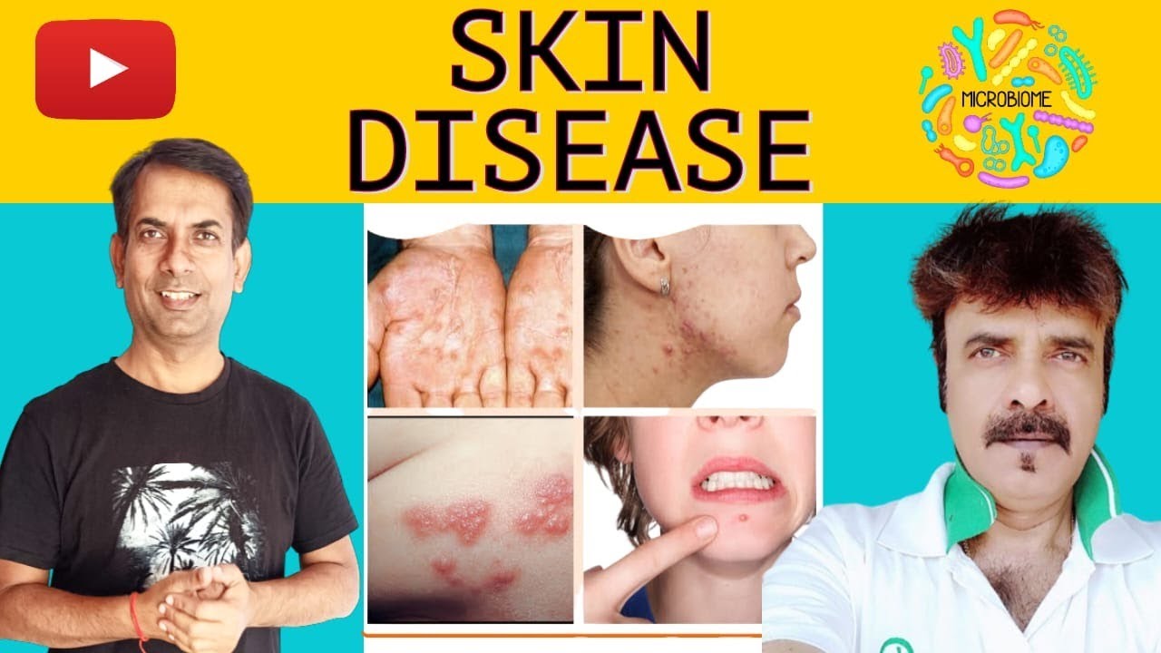 त्वचा संबंधी रोग :क्या है कारण और निदान? DR AWADHESH PANDEY
