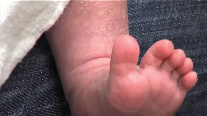 Help on Reducing the Risk of Birth Defects