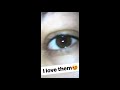Sweetyplus Cherry Yellow: Colored eye lenses