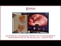 Decoding an Ultrasound Report with Diagrammatic Representation of the Pathology | Dysmenorrhea