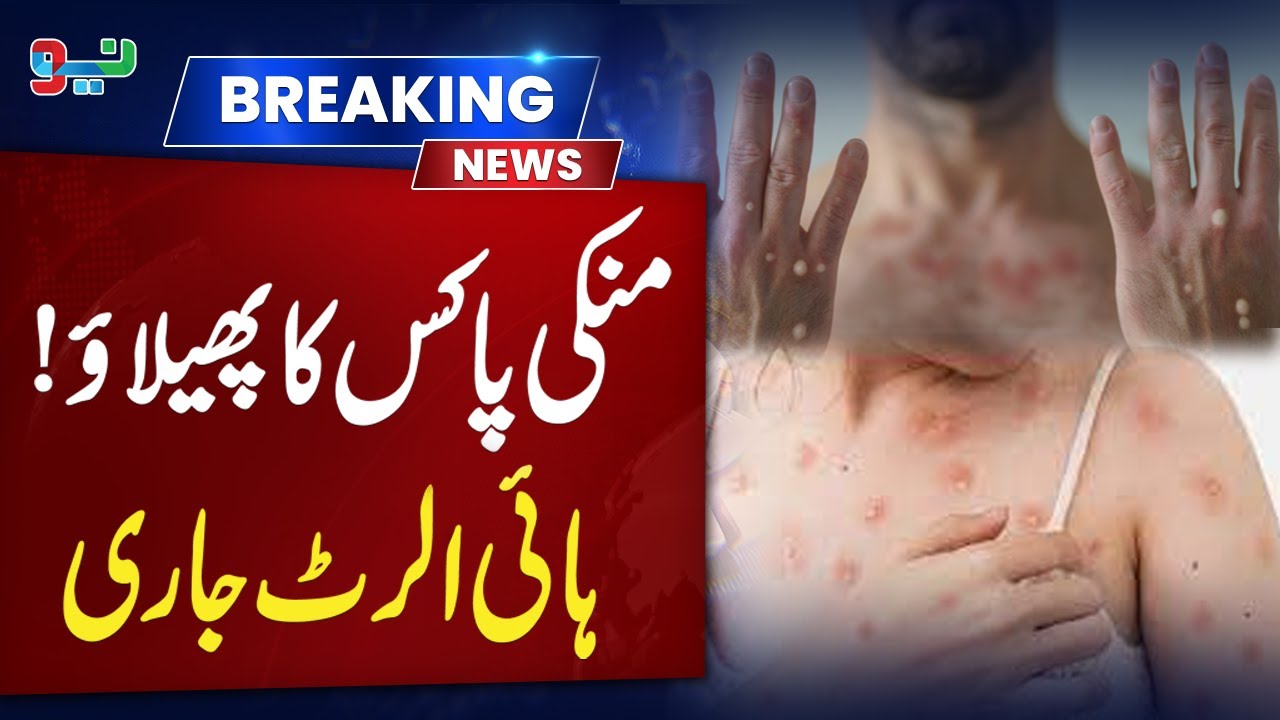 MonkeyPox Ka Phalaoo, High Alert Jari ! | Breaking News | 18 August ...