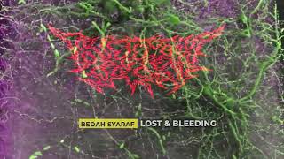 BEDAH SYARAF - LOST AND BLEEDING