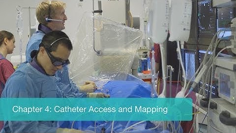 Efficient AF Ablation Workflow With CARTO®3 System And Ablation Index - Chapter 4