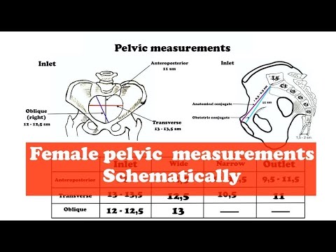 Video: How To Measure Your Pelvis