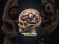 This is your brain during anxiety 🧠 #shorts #anxiety #brainfacts