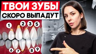 ОГОЛИЛИСЬ КОРНИ?! Как остановить рецессию десны? 5 факторов рецессии десны
