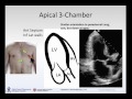 Introduction to Focused Cardiac Ultrasound: Part II