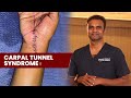 Carpal tunnel syndrome  dr sree charan