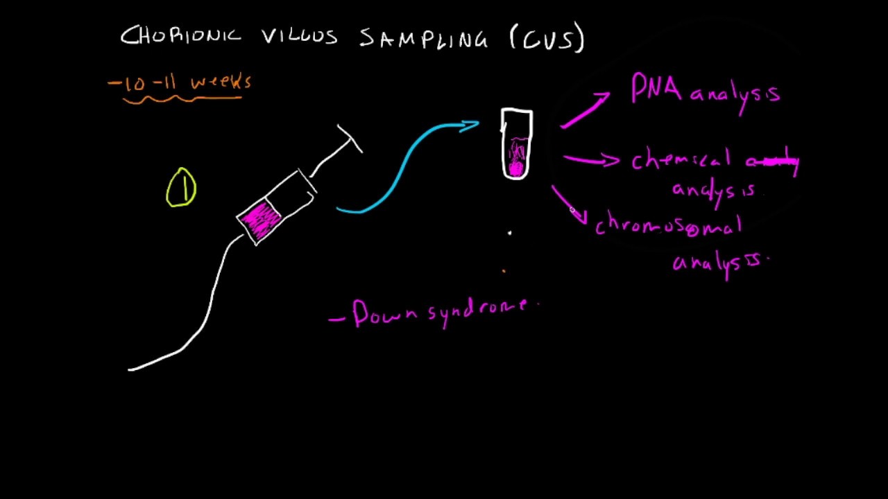 chorionic villus sampling youtube chorionic villus sampling