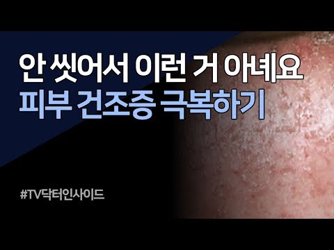 갑작스런 두드러기? 나에게 왜 이런 일이? 겨울철 가려움 주범은 피부건조증 !   어떻게 해야할까?  [TV 닥터 인사이드]