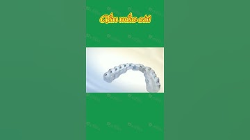 [3D] GẮN MẮC CÀI || Nha Khoa Quốc Tế Athena