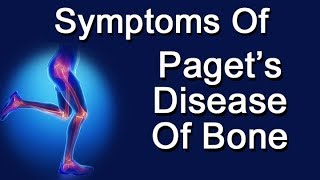 Symptoms Of Paget's Disease Of Bone