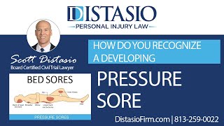 How do you recognize a developing bed sore?