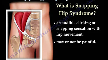 What causes iliopsoas snapping?