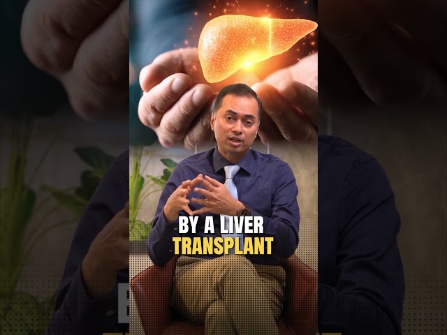 Who Needs a Combined Liver–Kidney Transplant? | Dr. Anand Ramamurthy Explains