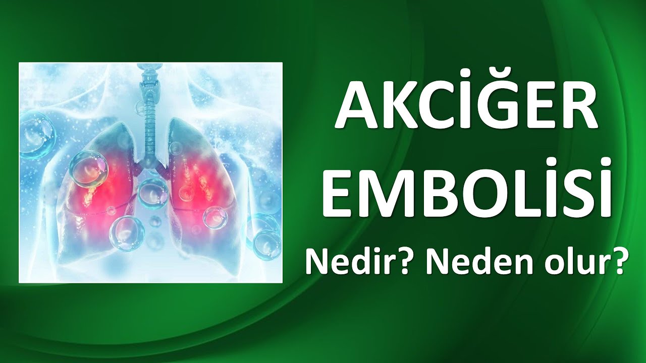 AKCİĞER EMBOLİSİ NEDİR? NEDEN OLUR? NASIL TEDAVİ EDİLİR?
