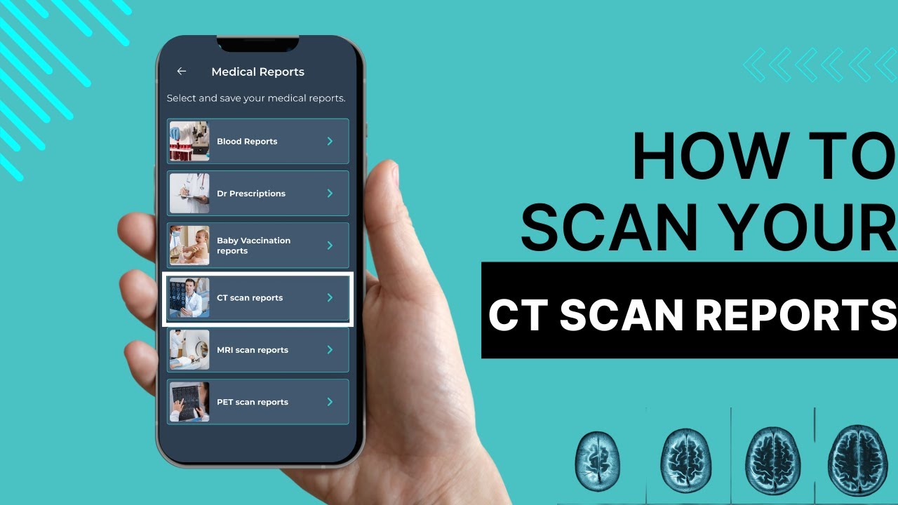 How to Scan and Store CT Scan Reports in Medugo App? - YouTube