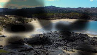 How Do You See Scotland? Diabetic Retinopathy