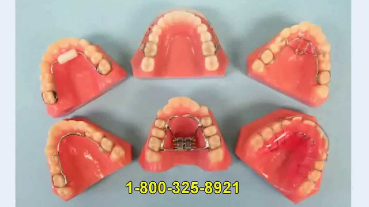 Habit Appliances Dental Habit Appliances Habit Appliance Labs YouTube