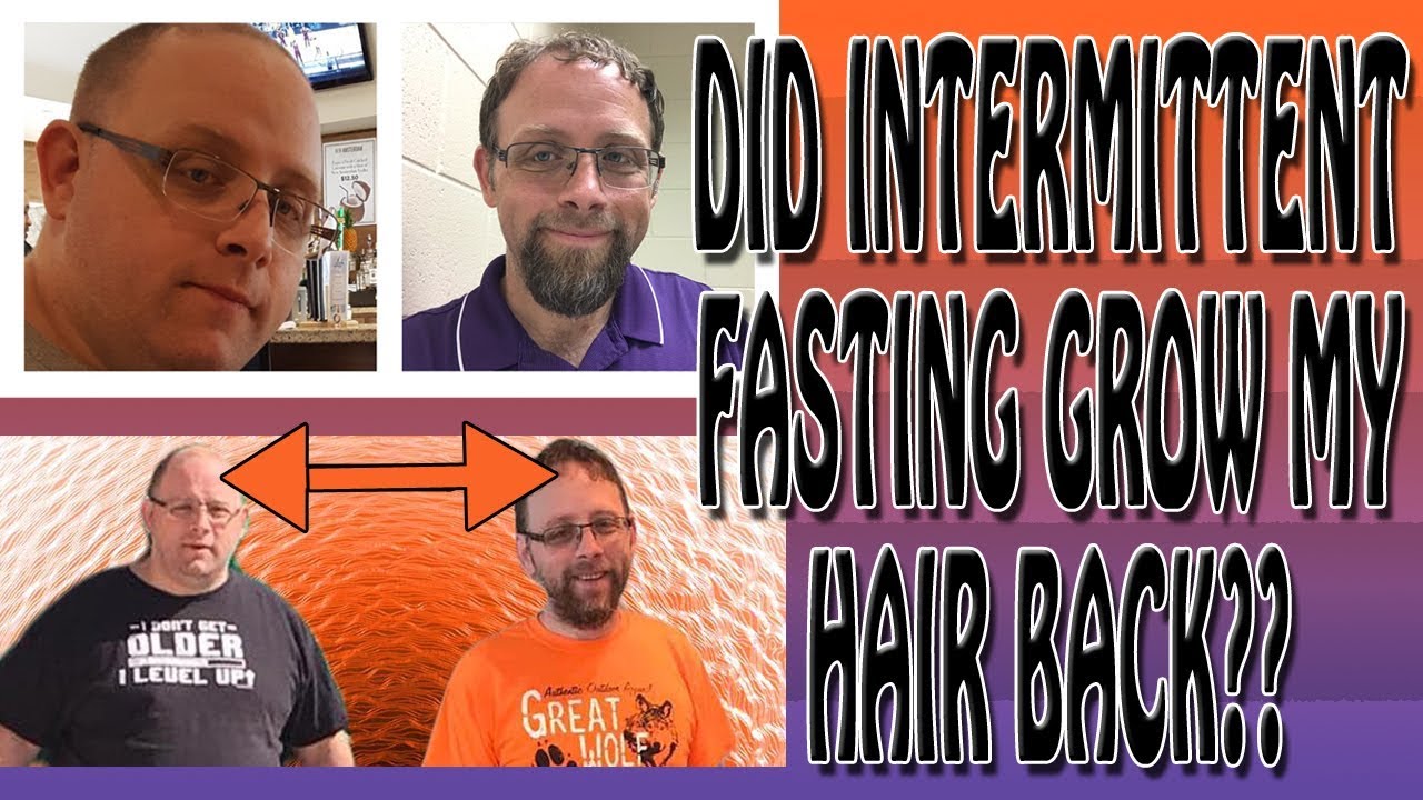Did Intermittent Fasting Grow My Hair Back YouTube