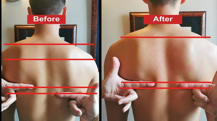 DROPPED SHOULDER FIXED! ~ Dr. Doug Willen