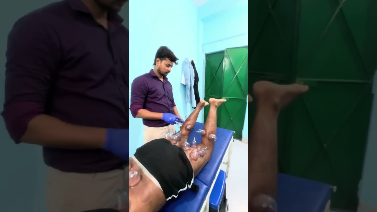 Cupping Therapy: Definition, Types & Benefits 