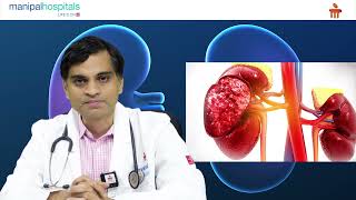 Chronic Kidney Disease | Dr. Sridhar A.V.S.S.N | Kidney specialist in Vijayawada Manipal Hospitals