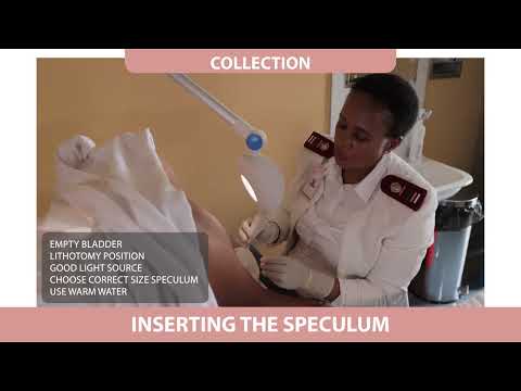 Pap Smear Video (LBC Technique) FULL LENGTH VERSION