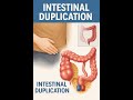 Intestinal Duplication