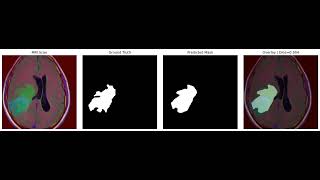 Segmenting Brain Tumor MRI Images | UNet | Deep Learning | Semantic Segmentation | Keras | Python 